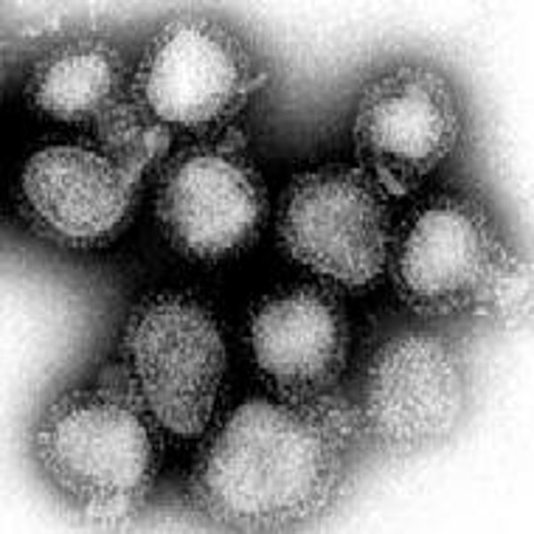 Hongkong Grippe epidemie